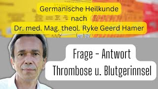 Germanische Heilkunde Frage  Antwort  Thrombose und Blutgerinnsel [upl. by Leahplar828]