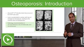 Osteoporosis Introduction amp Causes – Endocrine Pathology  Lecturio [upl. by Rainer]