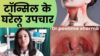 टॉन्सिल के घरेलू उपचार गले में दर्द का घरेलू इलाजhome remedies for tonsillitis [upl. by Backer]