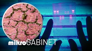 Biofilm – sposób bakterii na uniknięcie antybiotyków  mikroGABINET [upl. by Neroc392]