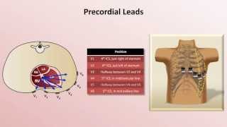 Intro to EKG Interpretation  EKG Leads [upl. by Kyte]