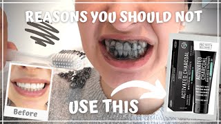 DENTIST review of CHARCOAL toothpaste amp powder  BEFORE and AFTER [upl. by Meadow]