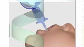 Neonatal Endotracheal Intubation [upl. by Cybill11]