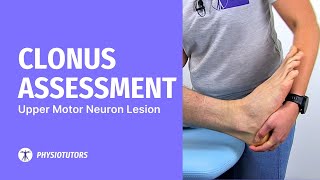 Clonus Assessment  Upper Motor Neuron Lesion [upl. by Soisanahta]