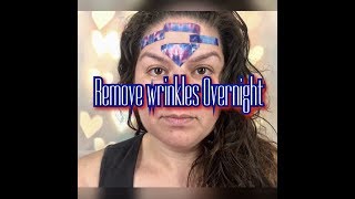 Get Rid Of Forehead Wrinkles Overnight Naturally [upl. by Barbur]