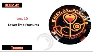 Lecture 10  Lower Limb Fractures  Trauma 42 [upl. by Irrol]