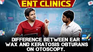 Difference Between Ear Wax amp Keratosis Obturans on Otoscopy  ENT Clinics with Dr Jagadish [upl. by Aerdma]