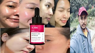 Dr alies vitamin c 15 face serum  honest review [upl. by Eidolem]