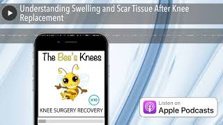 Understanding Swelling and Scar Tissue After Knee Replacement [upl. by Alinna]