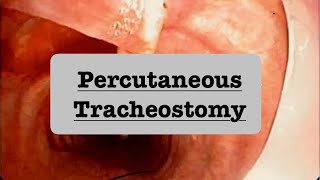 Percutaneous Tracheostomy procedure ultrasound and bronchoscopy guided doctor criticalcare [upl. by Cohby]