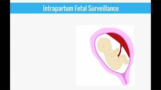 Intrapartum fetal monitoring everything explained [upl. by Albina]