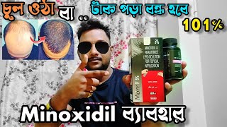 টাক পড়া বন্ধ জন্য minoxidil  Short discussion on minoxidil  Stop hair fall minoxidil [upl. by Gaylene]