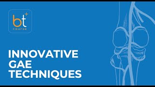 Course Preview Innovative Genicular Artery Embolization Techniques Two Case Studies [upl. by Ram]