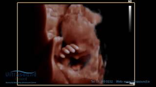 Scan of the Week 28 week baby waving hello during our 3D4D Ultrasound [upl. by Jilleen]