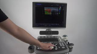 elastography of CHISON ultrasound [upl. by Thetis]