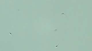 DFWFA Fertility Clinic Lab Video Motile Sperm [upl. by Preuss]