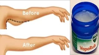 RUB FOR 7 DAYS LOOSE ARM FAT QUICKLY  REMOVE THIGH FAT [upl. by Ennaear360]