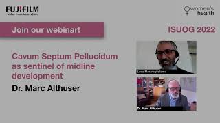 ISUOG 2022 Webinar  Cavum Septum Pellucidum as sentinel of midline development Dr Marc Althuser [upl. by Hearsh628]