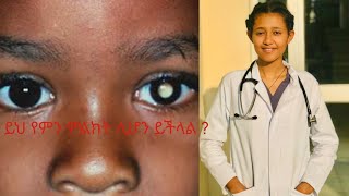 ረቲኖብላስቶማ retinoblastoma የአይን ካንሰር [upl. by Etrem]