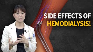 Hemodialysis Side Effects How It Works amp What You Need to Know [upl. by Adel459]