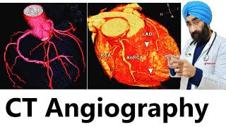 दिल में ब्लोब्केज है या नहीं जाने  Understand CT Coronary Angiography Kya hai  DrEducation [upl. by Elatsyrc]