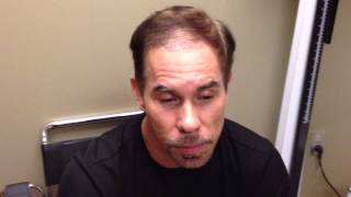 Joses Bosley Hair Transplant Review  2 weeks PostProcedure [upl. by Yssenhguahs797]