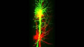 Double labeled neurons of brain slices [upl. by Arahs]