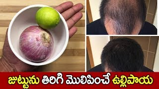 జుట్టును తిరిగి మొలిపించే ఉల్లిపాయ I Onion For Hair Growth I Health Tips I Everything in Telugu [upl. by Prudy]