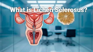 Lichen Sclerosus The Mysterious Skin Condition Explained [upl. by Eidaj116]