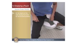 ColostomyIleostomy Emptying a Pouch [upl. by Vadim]