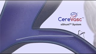 CereVasc Procedure Training Video [upl. by Carroll494]