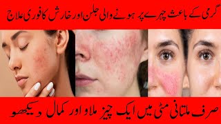 Allergy Treatment  Face Allergy and Redness Treatment  Cold Skin Polish at Home [upl. by Jeavons168]