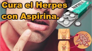 Cura el herpes MUY RÁPIDO de cualquier parte de tu cuerpo con una simple aspirina [upl. by Harri]