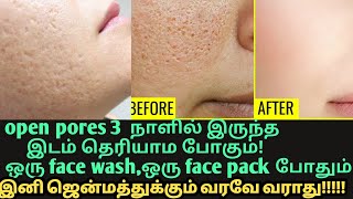 open pores முகத்தின் அழகை கெடுக்குதா2 pack3 நாள் போதும் open pores large pores remedy Tamil [upl. by Ramed]