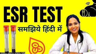 ESR TEST IN HINDI youtube youtbevideos video laboratory shortvideos doctor [upl. by Beatrix]