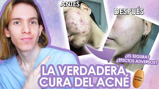 ROACCUTAN o ACCUTANE Efectos adversos como tomarla antes y despues LA VERDAD de la ISOTRETINOINA [upl. by Nerti]