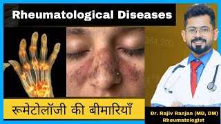 रूमेटोलॉजी की बीमारिया  Common Rheumatological Diseases [upl. by Wilkison]