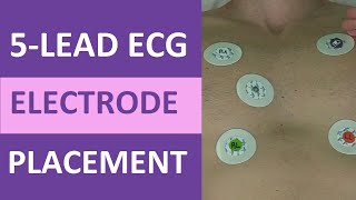 5 Lead ECG Placement of Electrodes EKG NCLEX amp Nursing Mnemonic [upl. by Adekahs]