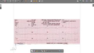 ECG Paper [upl. by Avehstab639]