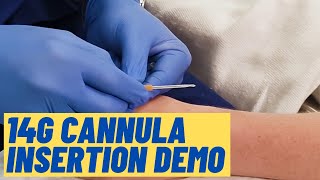 Large 14G cannula insertion technique  Live Demo [upl. by Dyol]