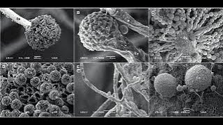 Las aflatoxinas un tóxico presente en los alimentos y sus efectos biológicos en humanos y animales [upl. by Ahsayn]