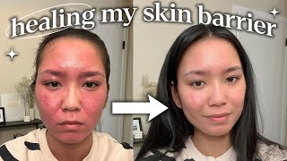 how i repaired my skin barrier not sponsored [upl. by Penrose]