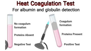 Heat Coagulation Test for identification of Albumin and Globulin  Knowledge Academy [upl. by Ehgit]