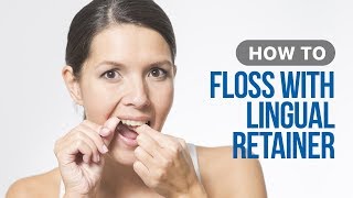 How to Floss with Lingual Retainer [upl. by Delora]