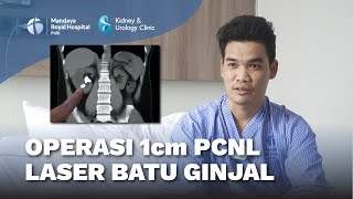 Operasi Batu Ginjal dengan Laser PCNL Hancurkan Batu Ukuran 2 cm  dr Maruto Harjanggi SpU [upl. by Idnarb516]