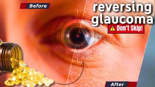 This Vitamin Reverses GLAUCOMA  A Potential GameChanger glaucomaawareness glaucomatreatment [upl. by Aratihc]