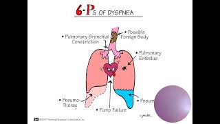 Pathophysiology and Management [upl. by Laynad46]