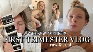 RAW amp REAL FIRST TRIMESTER VLOG weeks 512 morning sickness remedies tips processing pregnancy [upl. by Tabina]