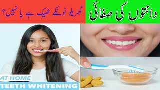 Teeth whitening Home RemediesGhar Mai daant white kareGarelo totke [upl. by Aschim]