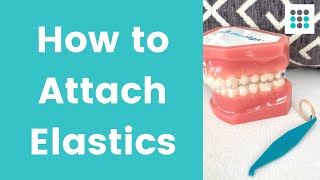 HOW TO PUT ELASTICS ON CLEAR ALIGNERS l Dr Melissa Bailey [upl. by Aillemac]